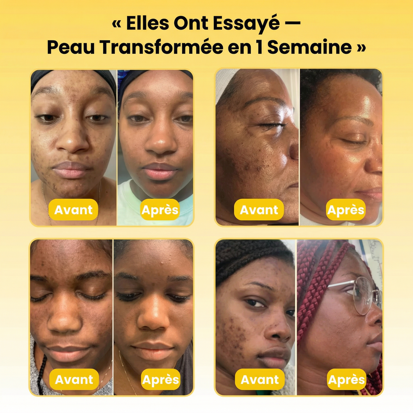 Masque de nuit à l'acide kojique et au curcuma